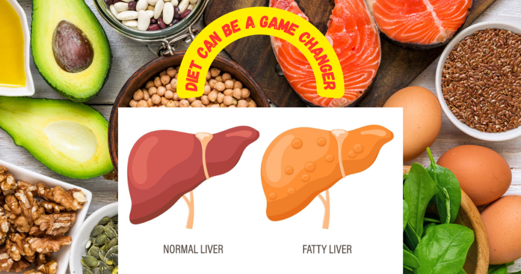 21 Day Fatty Liver Diet Plan